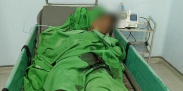 Pemuda 19 Tahun di Pangkalpinang Dibacok OTD, Kelima Jari Tangannya Putus