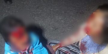 Lampu Penerangan Minim Picu Kecelakaan Pengguna Jalan, Rocky Husada Minta Dishub Bertindak